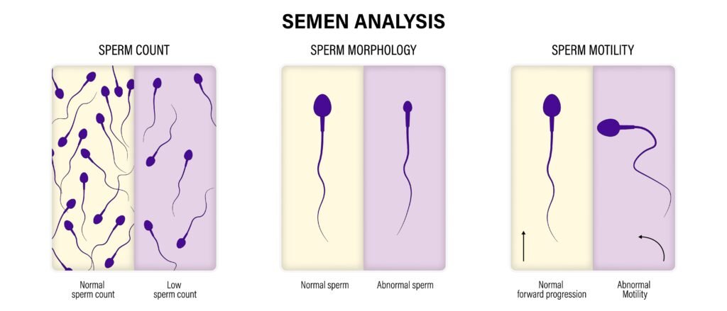 Learn Equine Semen Analysis diagram showing sperm count, sperm morphology, and sperm motility with normal vs abnormal examples